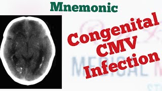 Congenital CytomegalovirusCMV triad Mnemonic [upl. by Latnahc]