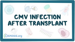 CMV infection after transplant [upl. by Akiram594]