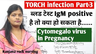 Torch infection in pregnancy part 3  cytomegalovirus causes and mode of transmission amp symptoms [upl. by Quinton]