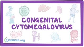 Congenital CMV  causes symptoms diagnosis treatment pathology [upl. by Narret549]