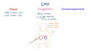 CMV Clinical Syndromes  Mono Congenital Infection Immunocompromised Hosts [upl. by Donahoe]